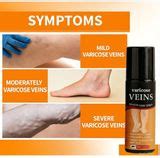 Herbs Library Vericose Vein Spray - Muscle Recovery Support Muscle Ease ...