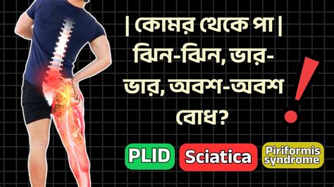 90% মানুষ ভুল diagnosis করে Sciatica না PLID?⚠️ নাকি Piriformis ...