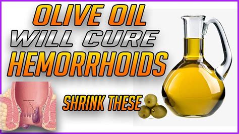 How To Get Rid Of Hemorrhoids Fast Naturally - Home Remedies To Get Rid Of Hemorrhoids - YouTube