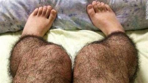 Apparently This Matters Hairy Leg Stockings Cnn