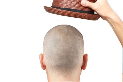 Reverse Balding Cap Here Comes A Device To Regrow Hair On Bald Head