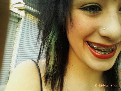 girls with braces on twitter look at that smile braces y2rtfwcqe6