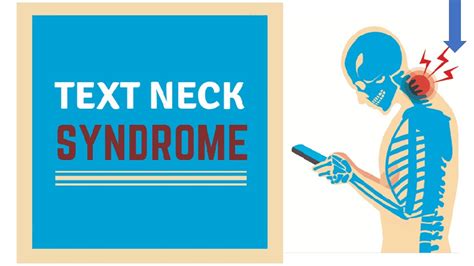 Text Neck Syndrome