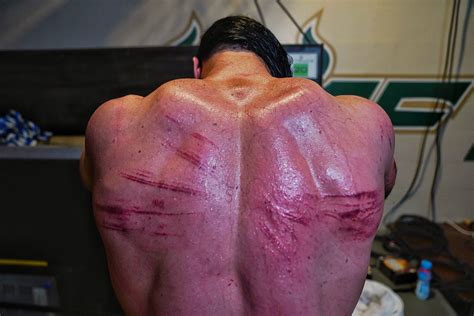 Drew Mcintyre Posts Photos Of Scars From Hell In A Cell Reacts To Wwe