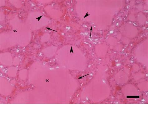 Histopathological Appearance Of The Thyroid Colloid Goitre From A Calf