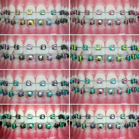 Orthodontics Apocalypse Now And Then Cute Braces Colors Braces Teeth Colors Cute Braces