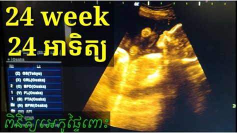 ពិនិត្យឣេកូផ្ទៃពោះ 6ខែ Pregnancy Ultrasound 24 Week By Drbun Laysophea