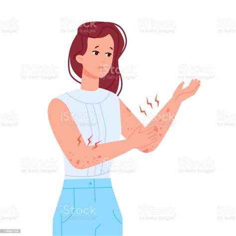 Woman Scratching Skin Girl With Itching Elbow Hand Or Rash On Body