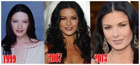 Blepharoplasty Catherine Zeta Jones Before And After Photos ~ Celebrity