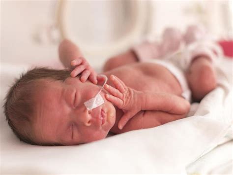 What You Should Know About Prematurity Root For Kids