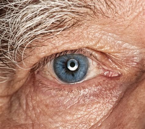 Aging Eyes Vision Changes To Watch Out For As You Grow Older