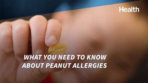 What You Need To Know About Peanut Allergies Health Youtube