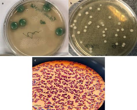Candida Albicans Culture By Daniela Beckmann Science Photo Library