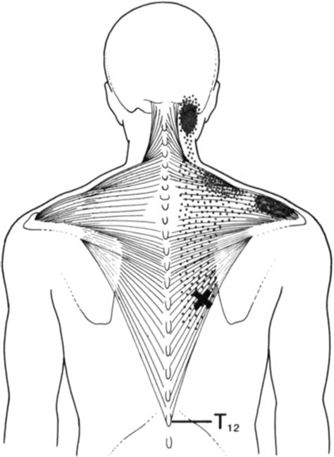 Common Shoulder Diagnoses Musculoskeletal Key