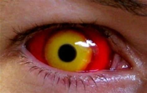 10 Insanely Weird Contact Lenses