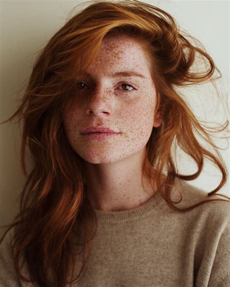 Pin On Freckles Gingers Red