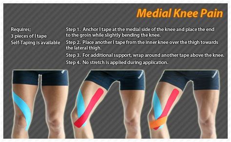 10 Of The Best Strengthening Exercises For Knee Pain Physical Fit
