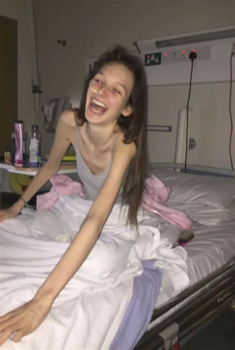 Five Stone Anorexic Irish Teenager Had To Be Force Fed By Doctors To Save Her Life Rsvp Live