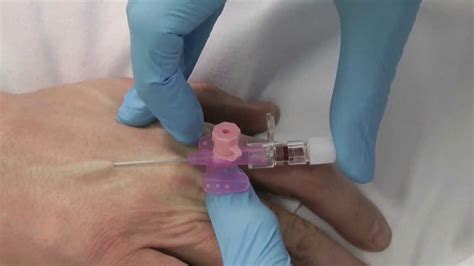 Cannulation How To Insert A Cannula One Minute Edition Medicine In A Nutshell Iv Access