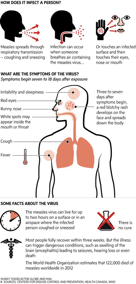 Graphic What Are The Signs And Symptoms Of Measles The