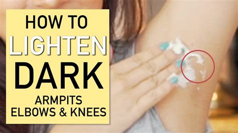 How To Lighten Dark Armpits Elbows And Knees Youtube