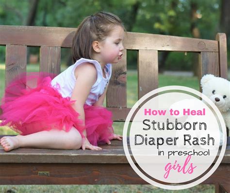 How To Heal Diaper Rash In Toddlers Diaper Rash Baby Diaper Rash Diaper