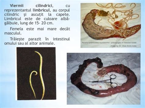 Boli Produse De Viermii Paraziti La Om Despre Via A Din Rom Nia