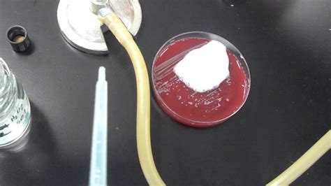 h2o2 en agar sangre peroxido de hidrogeno catalasa agua oxigenada youtube