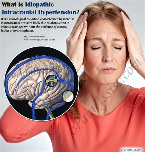 Idiopathic Intracranial Hypertensioncausessymptomstreatment