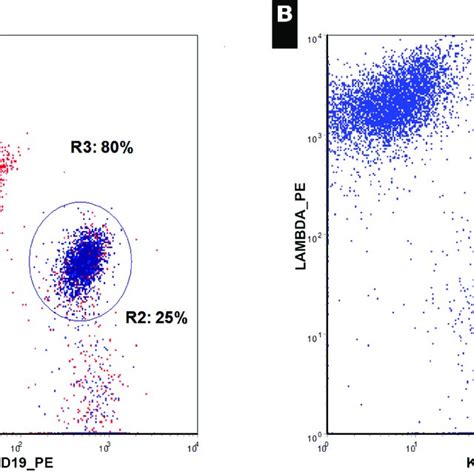 Flow Cytometry Of Mantle Cell Lymphoma In The Peripheral Blood 2015