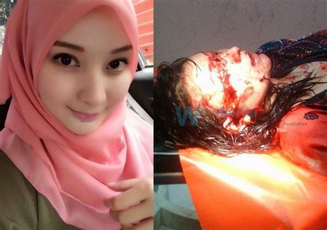 Video viral wanita ini curhat, ibunya diarak dan diikat di pohon, sempat dipukul saat mau menolong. Gadis Cantik Parah Ditoreh Penyamun Di Kelantan | BEST FBKL