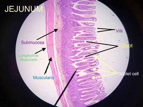 Jejunum Histology Slide With Labeled Diagram And Iden Vrogue Co