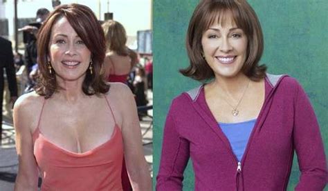 Digging jiggers, before and after! Patricia Heaton Plastic Surgery Before And After Photos