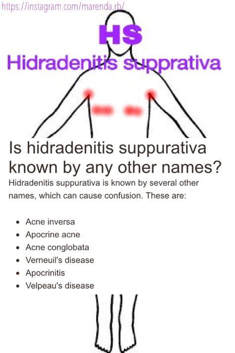 15 Best Hidradenitis Suppurativa Help Images Autoimmune Disease The
