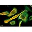 Human Thymic Epithelial Cells Stained For Pan Cytokeratin Green And 