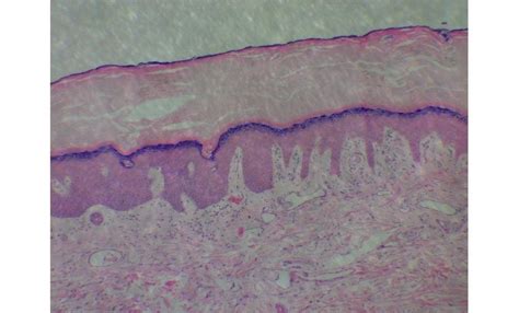 Solved Label The Epidermis Dermal Layer And Sweat Gland Duct If