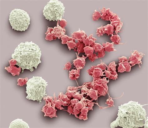 White Blood Cells And Platelets Photograph By Steve Gschmeissner