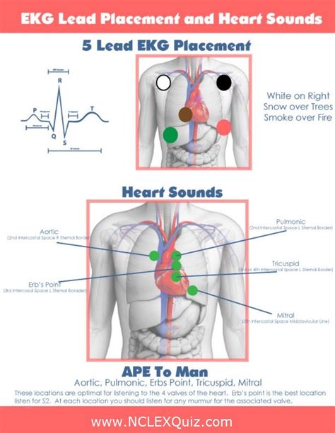 5 Lead Ekg Placement And Heart Sounds Nclex Quiz Ekg Placement Ekg