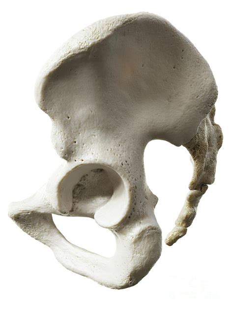 Hip Bone Photograph By Sebastian Kaulitzkiscience Photo Library Fine