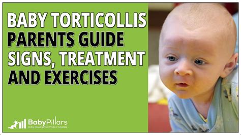 A Quick And Easy Guide To Baby Torticollis Signs Treatment And