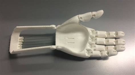 Bringing 3d Printed Prosthetic Hands To Third World Countries
