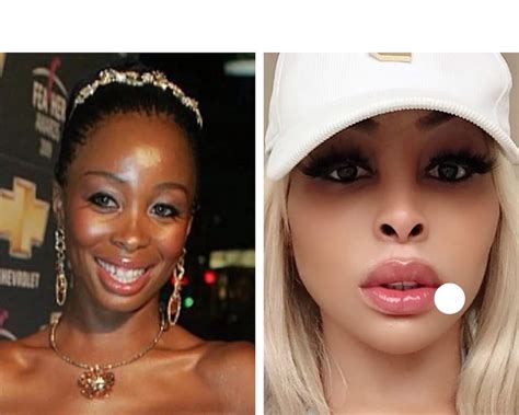 Sa Celebrities Before And After Plastic Surgery Photos South Africa My Xxx Hot Girl