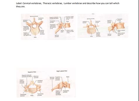 Solved Label Cervical Vertebrae Thoracic Vertebrae Lumbar Chegg Com