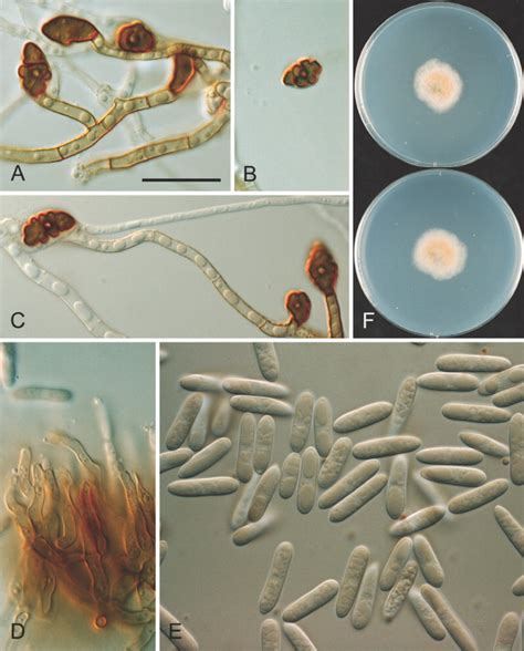 Colletotrichum Aeschynomenes Icmp 17673 Ex Holotype Culture Ac