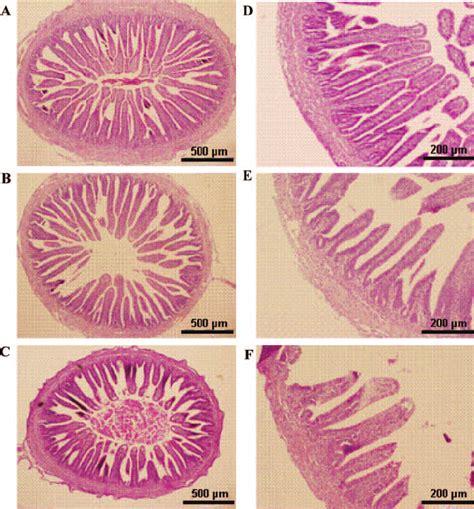 Representative Light Microscopic Histological View Of Intestinal Villi