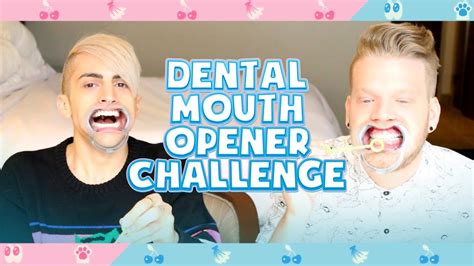 Dental Mouth Opener Challenge Youtube