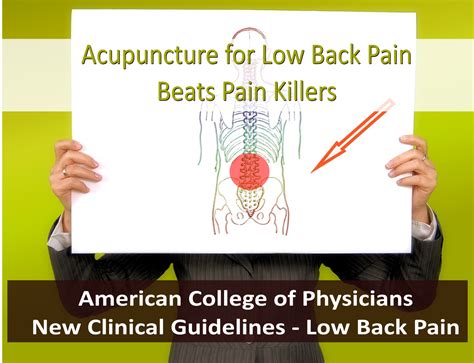 Acupuncture For Low Back Pain Beats Pain Killers New Guidelines