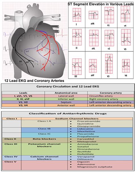 12 Lead Ecg Cheat Sheet Sheet Images And Photos Finder