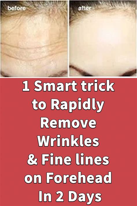 1 Smart Trick To Rapidly Remove Wrinkles Fine Lines On Forehead In 2