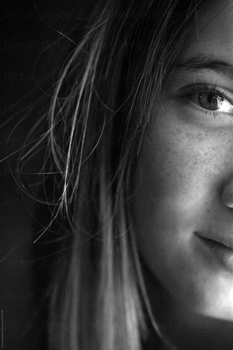 Gorgeous Portrait Of Half Teenagers Face With Freckles And Bright Eyes